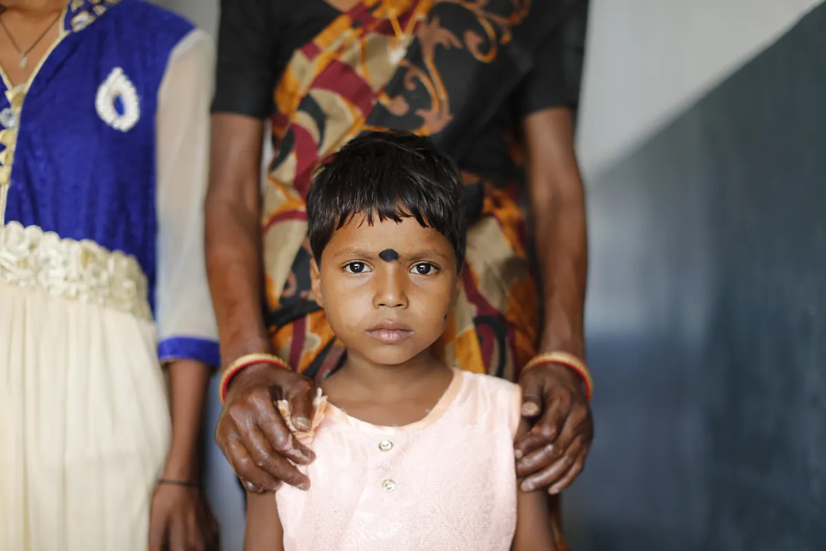 Fillette indienne atteinte de la lèpre